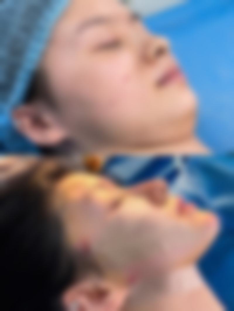 李秋彤医生坐诊信息及预约方式