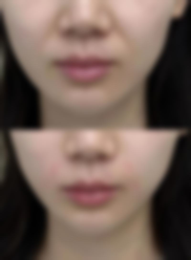 北京卓新华星整形医院口碑评价
