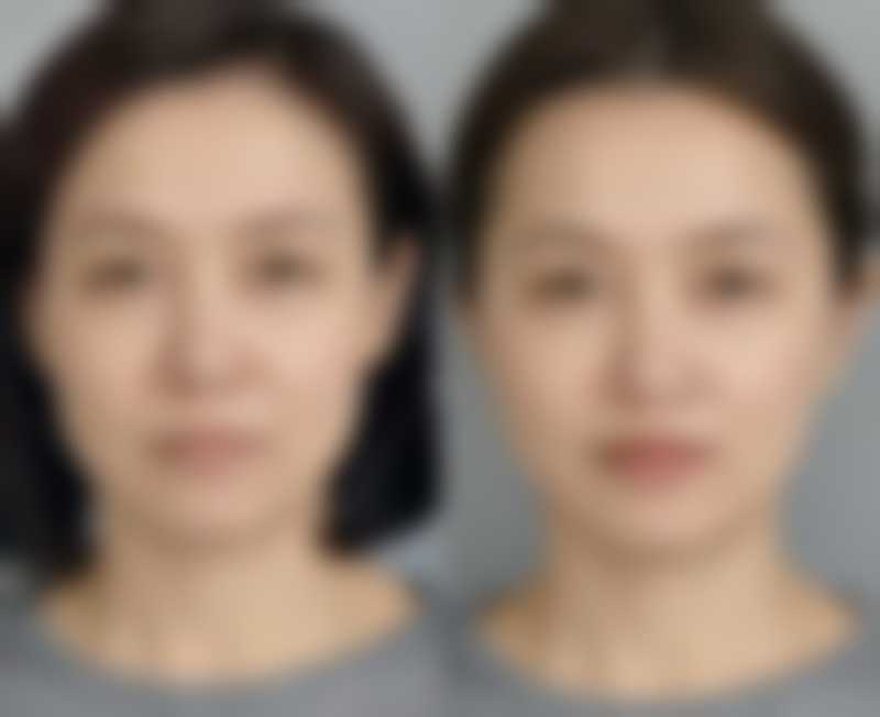 李秋彤医生手术成效展示
