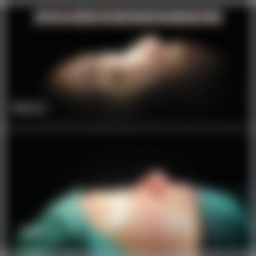 三、杨承禹医生擅长项目与适合人群