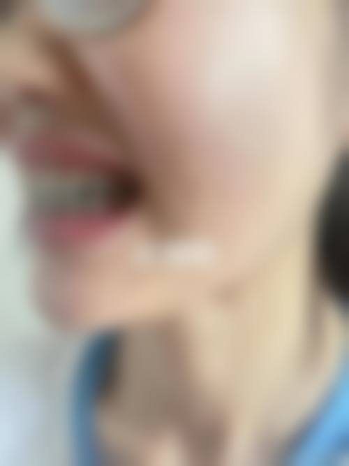 临床实例分享