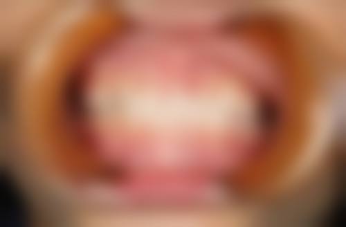 温州医 科 大学附属口腔医院儿童口腔科擅长项目。
