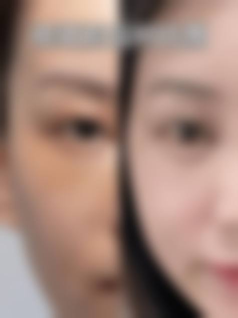 适用人群与建议