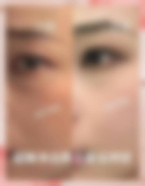 术后护理秘籍:这些坑我替你们踩过了