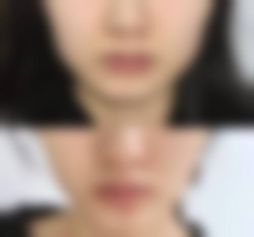 八、如何选择安心可靠的面部吸脂医生