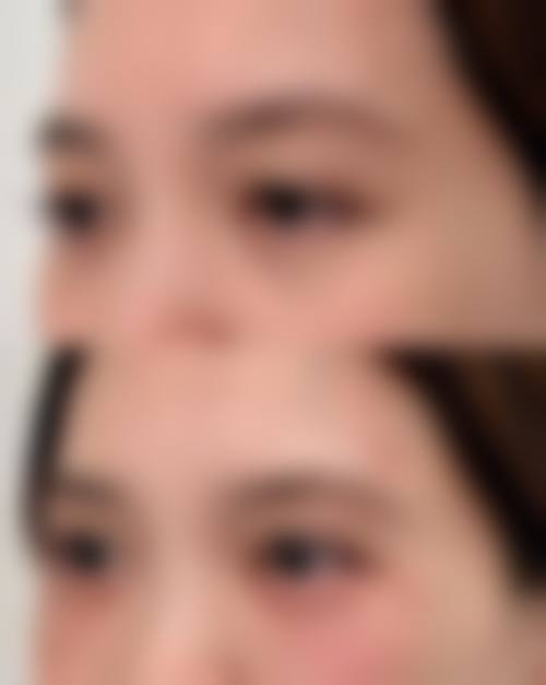 昆明悦玲珑医疗美容医院2026年价格收费表: