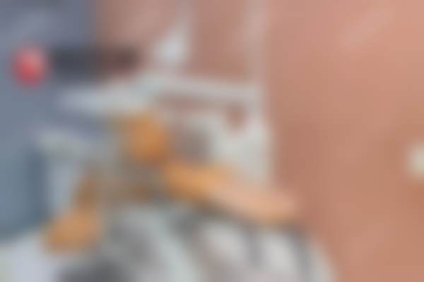 武汉爱齿尔常青口腔门诊部治疗反馈与口碑评价。