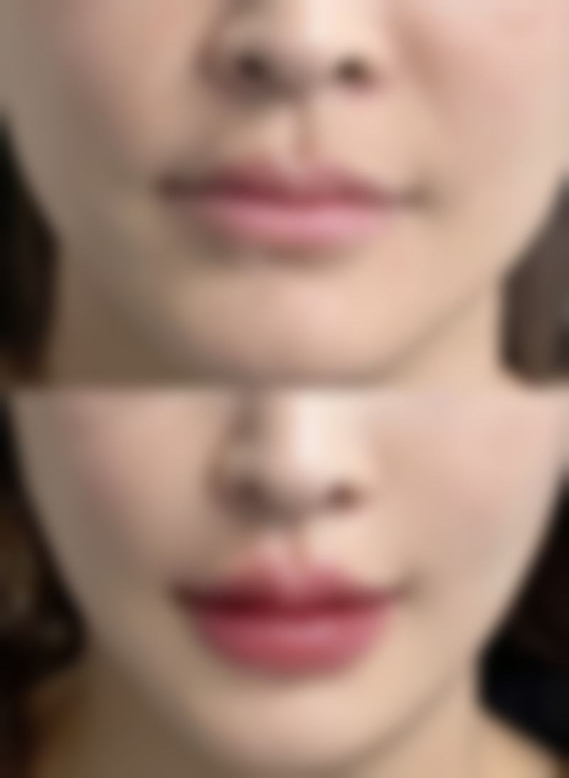韓國必妩尹院長實力點?《Let美人》執刀+20年經驗拆解