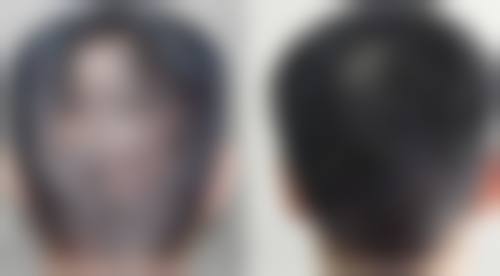 北海红粉丽人整形医院预约挂号指南