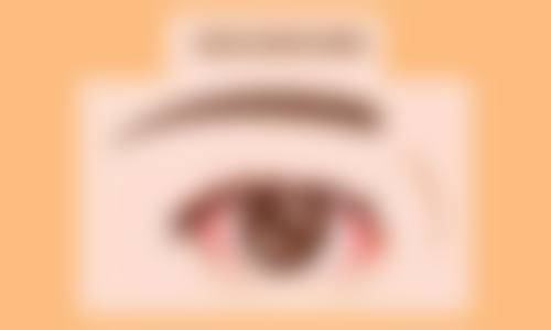 四、矫正秘诀——配镜矫正全解析
