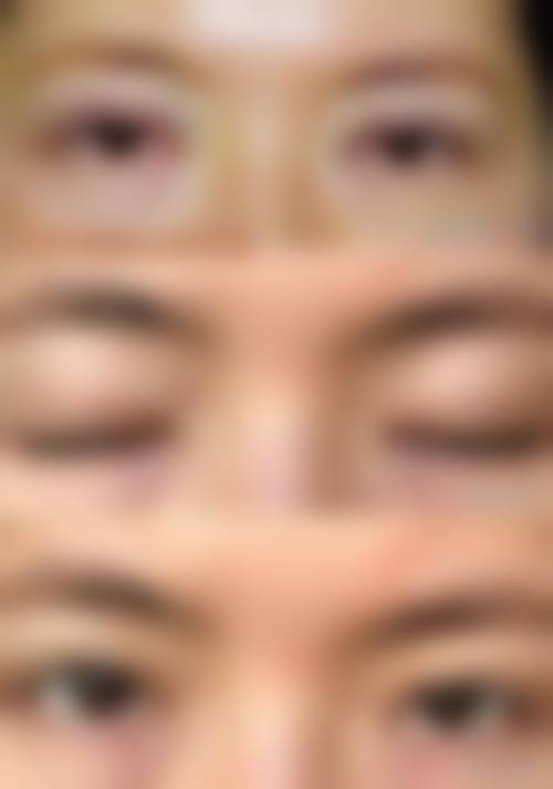 佛山瓷美颜整形医院擅长项目。