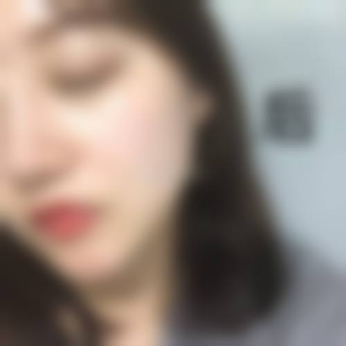爱贝芙是胶原蛋白吗？不是！含PMMA微球+胶原蛋白溶液，2026三甲医师亲诊8800元/支，维持5-8年！