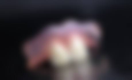 上海松丰牙科整形医院治疗反馈与口碑评价。