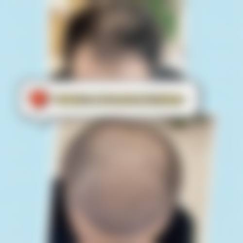 喀什朵美医疗美容门诊部擅长项目。