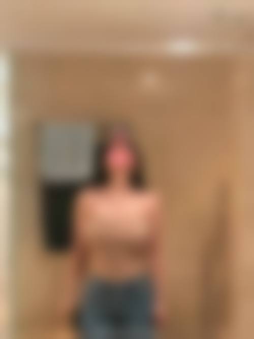 韓國自體脂肪隆胸存活率高嗎？2026權威醫生實測70%+，3招提存不結塊秘訣