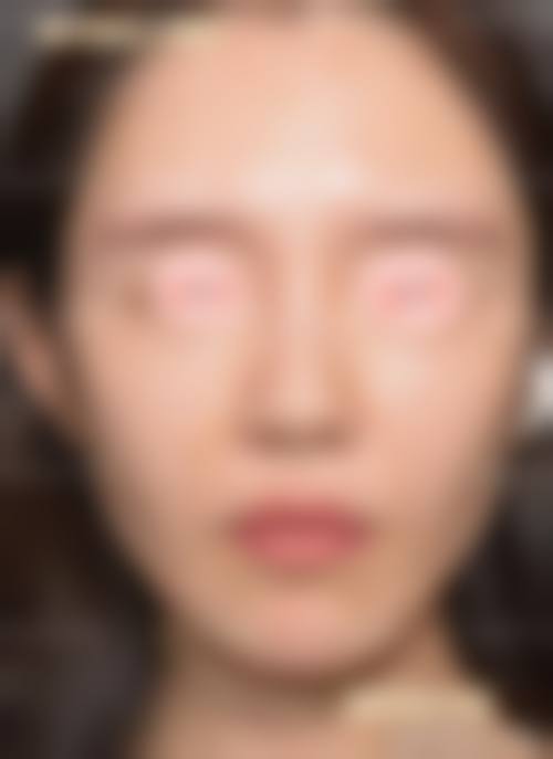 韓國鼻整形會唔會頂到發亮 關鍵選擇點總結