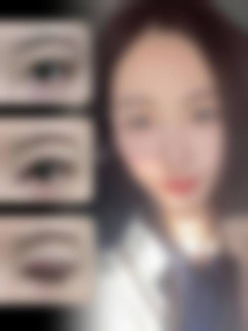 绵阳市人民医院烧伤整形美容外科治疗反馈与口碑评价。