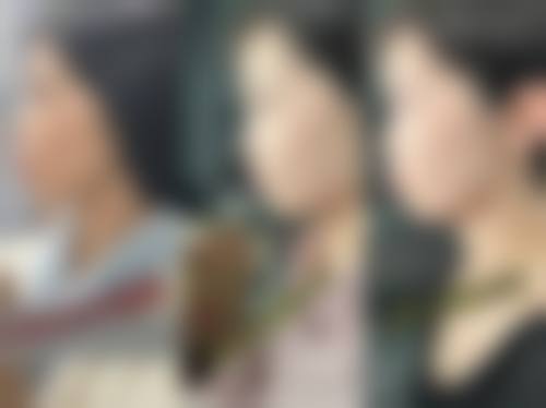 福建宁德寿宁县河马口腔治疗反馈与口碑评价。