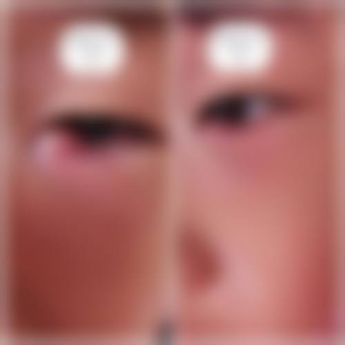 深圳德视佳眼科门诊部治疗反馈与口碑评价。