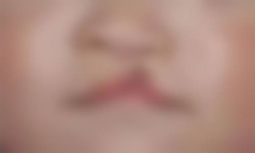鹰潭美嘉医疗美容医院擅长项目。