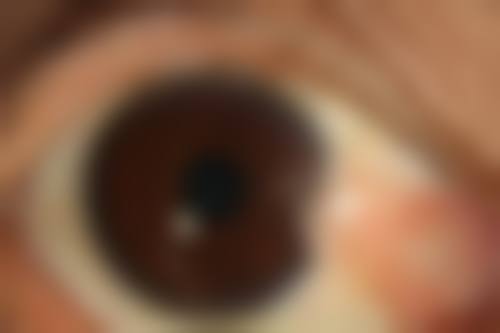 武汉儿童医院眼科口碑评价