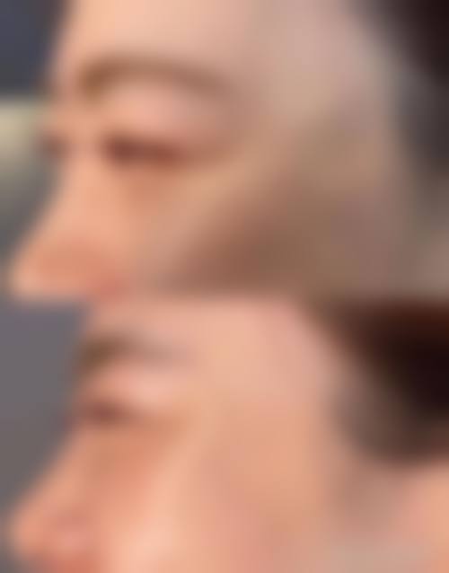 遵义中科美美整形医院治疗反馈与口碑评价。