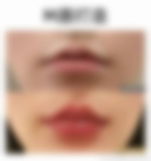 武汉德美整形美容医院擅长项目。