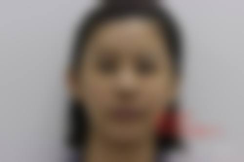 武汉德美整形美容医院治疗反馈与口碑评价。