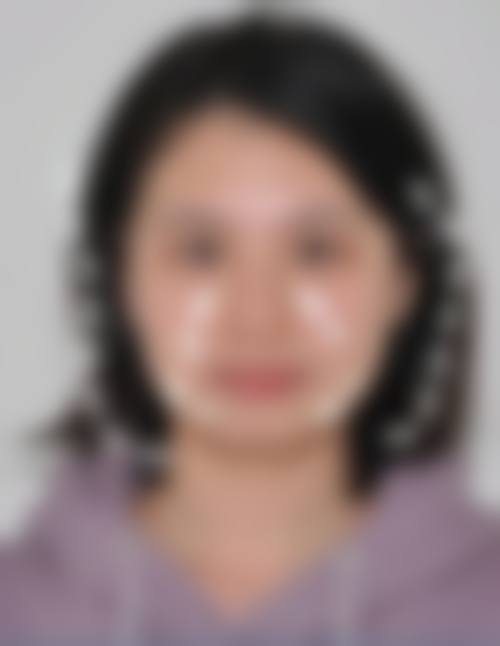 二、金惠英医生擅长项目