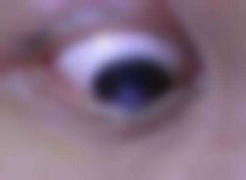 结语:选择专精眼科,守护清晰视界