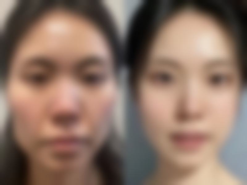 拓展延伸:韓國Nano項目真相+關鍵選擇點