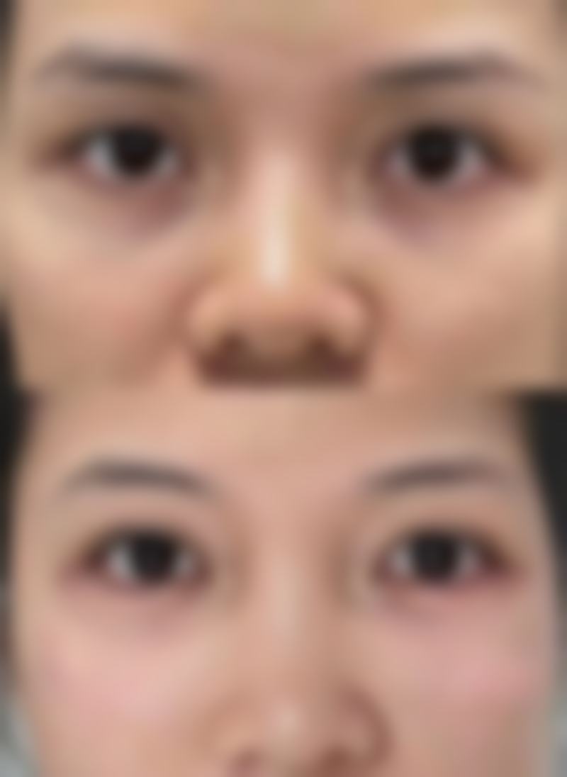 烟台鹏爱宝丽美容整形医院预约挂号指南
