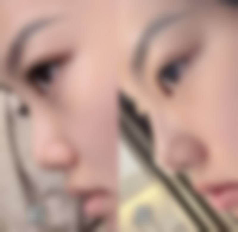 烟台鹏爱宝丽美容整形医院价格表/收费标准一览