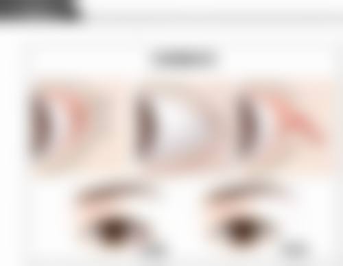 韓國baid皮膚科怎麼預約掛號 診所揀選3大要點(附港澳姊妹真實实例)