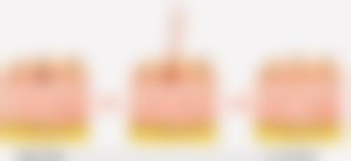 韓國鼻整形真相:香港姊妹更關心嘅3個問題
