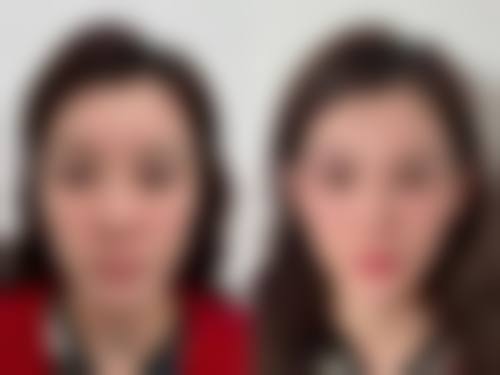 临床实例分享