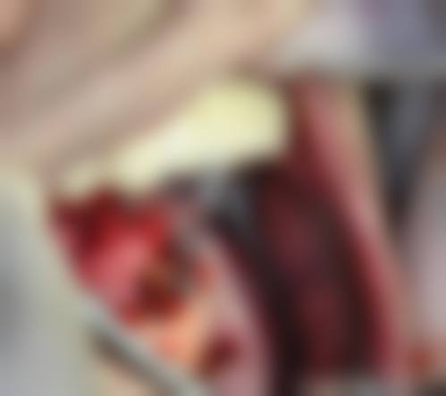 北京华烨新北口腔唐家岭口腔治疗反馈与口碑评价。