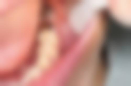 北京华烨新北口腔唐家岭口腔预约挂号方式。
