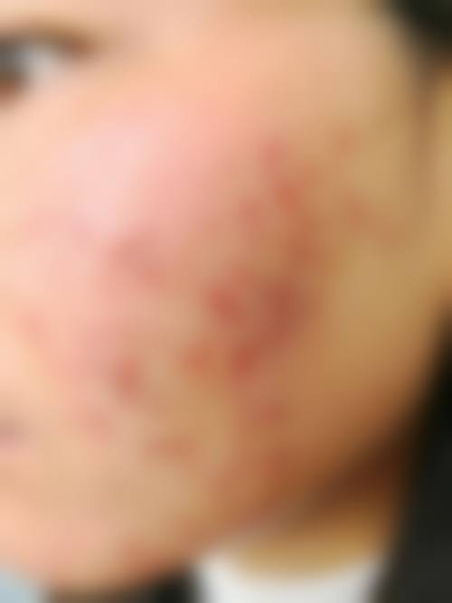 患者真实评价