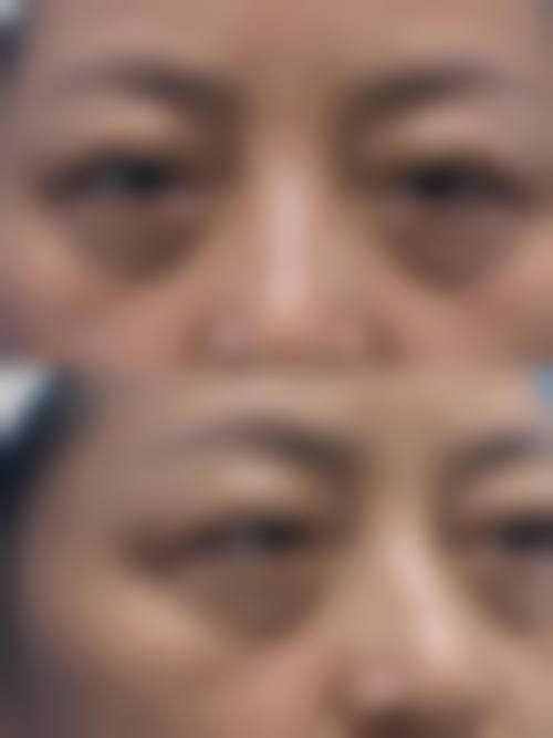武汉柠悦医疗美容门诊部治疗反馈与口碑评价。