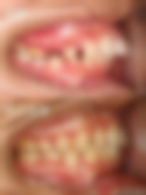 口腔项目优惠活动详情