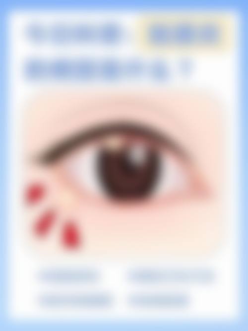 广元万江眼科医院预约挂号方式。