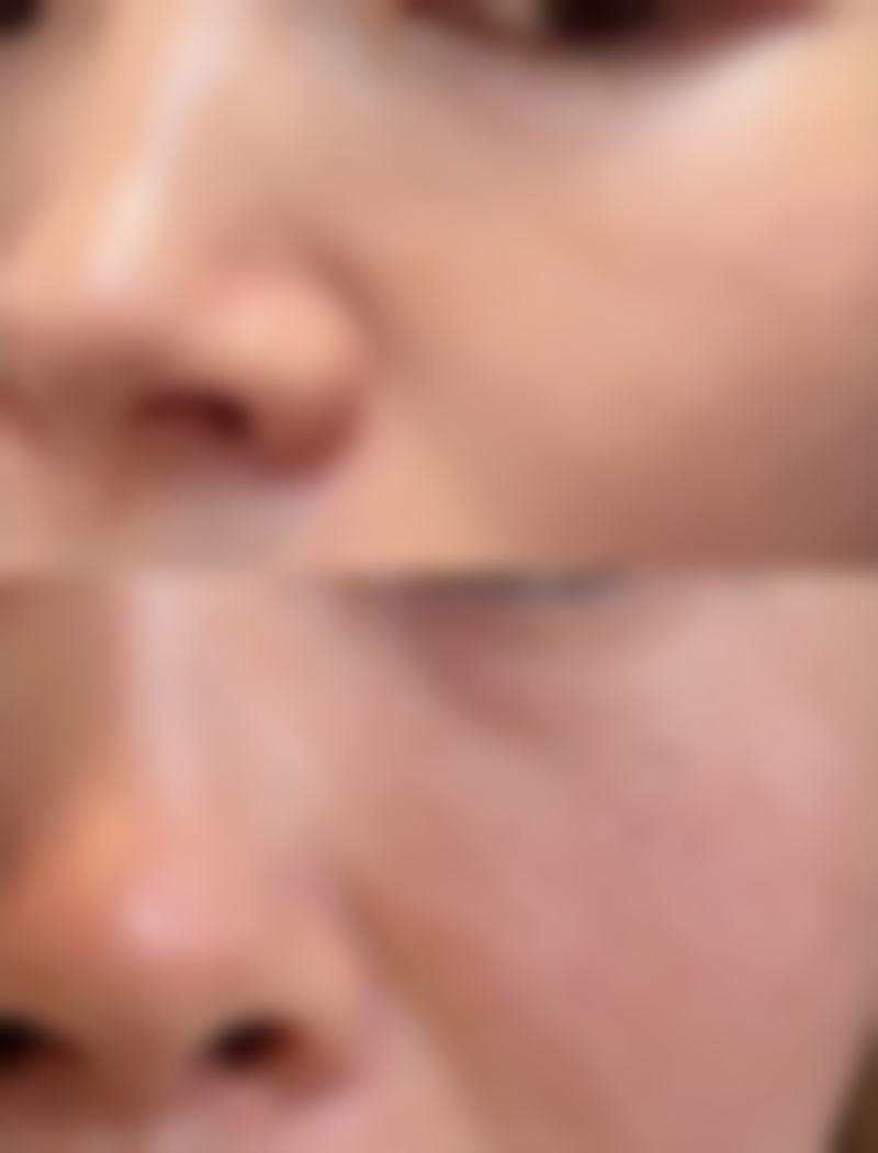 韓國baid皮膚科怎麼預約掛號 術前術後避坑指南(港澳姊妹必睇)