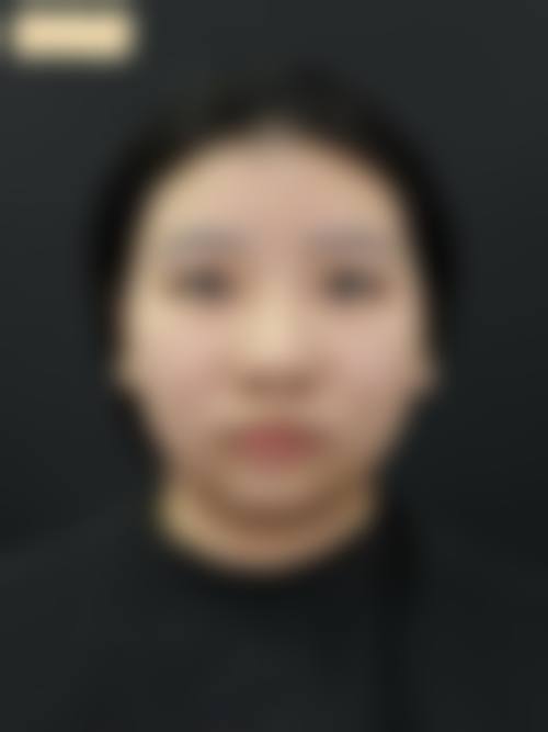 理性提醒