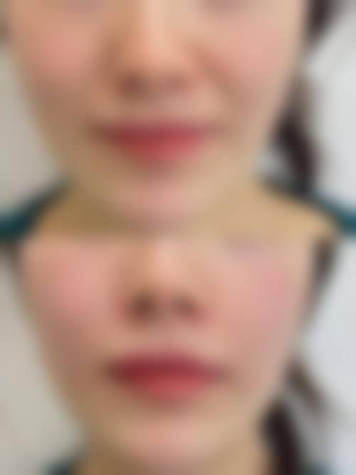 特色项目与优势:个性化脱发治疗与医美定制