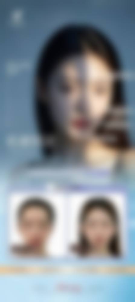 真實实例公開:香港姊妹VS澳門媽咪嘅輪廓手術體驗