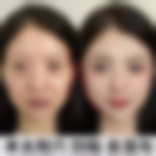 合肥市第二人民医院医生团队经验稳定。