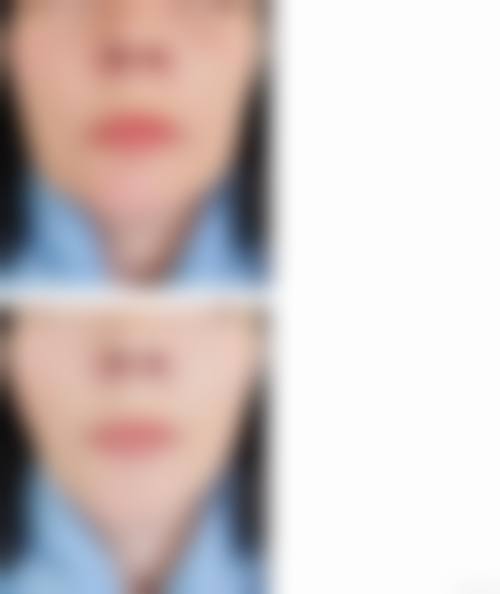 合肥市第二人民医院擅长项目。