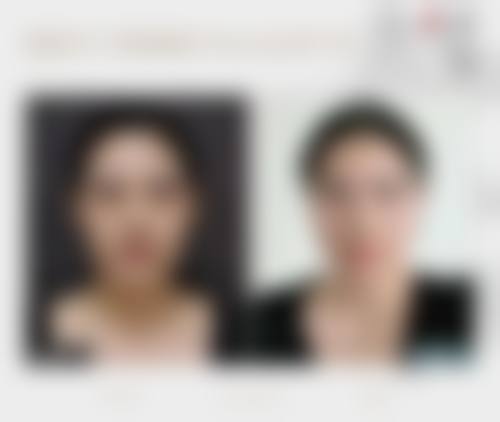韓國必妩輪廓手術好唔好 適合邊類人群?