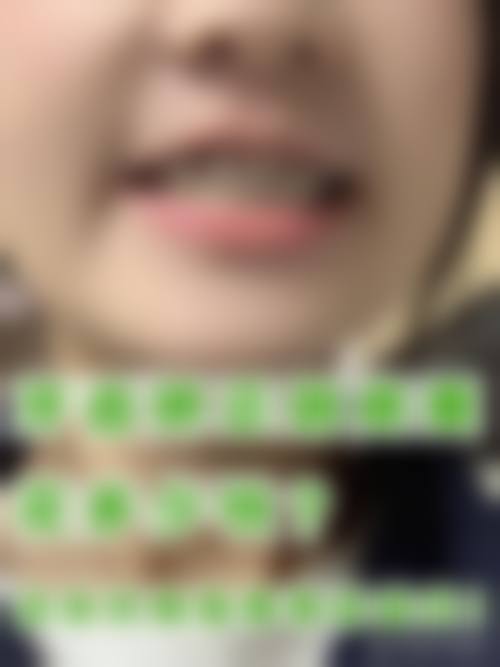 随州惠康口腔诊所预约挂号方式。